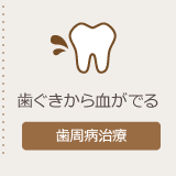 歯周病の治療