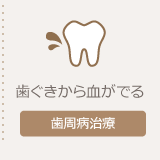 歯周病の治療