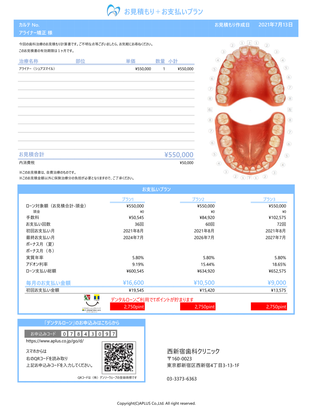 マウスピース矯正のお支払い方法